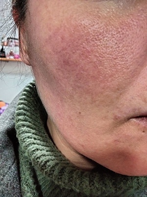 Nous l'avons essayé Free Skin de Talika