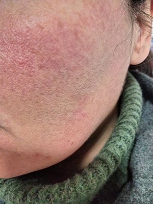 Nous l'avons essayé Free Skin de Talika