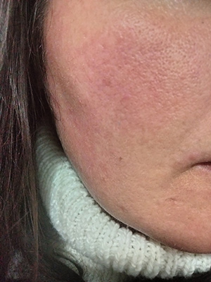 Nous l'avons essayé Free Skin de Talika