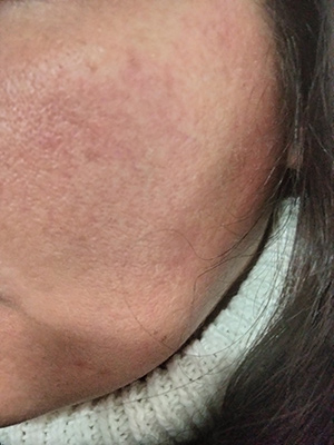 Nous l'avons essayé Free Skin de Talika