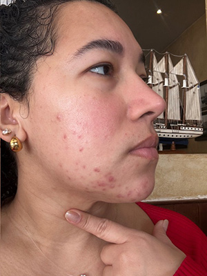 We probeerden Azelaic Radiance Serum van Freshly