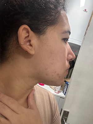 We probeerden Azelaic Radiance Serum van Freshly