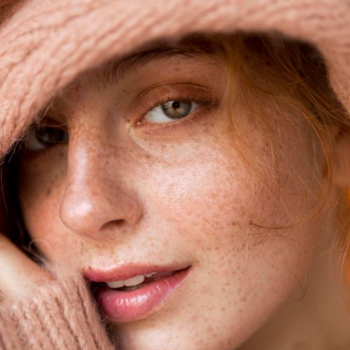 Peau sèche en hiver