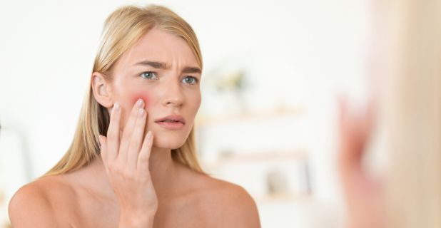 crèmes cicatrisantes