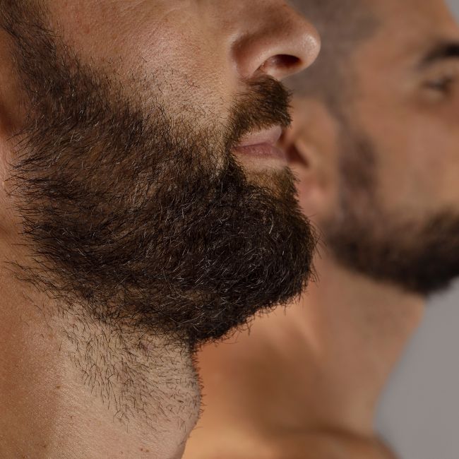 Protuberâncias na barba: por que aparecem e como você pode preveni-las.