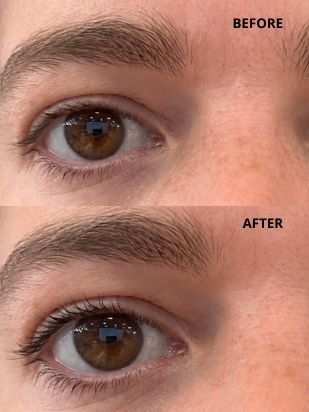 We tested Anto serum