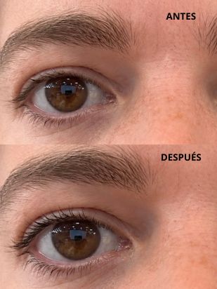 Lo Probamos Anto serum