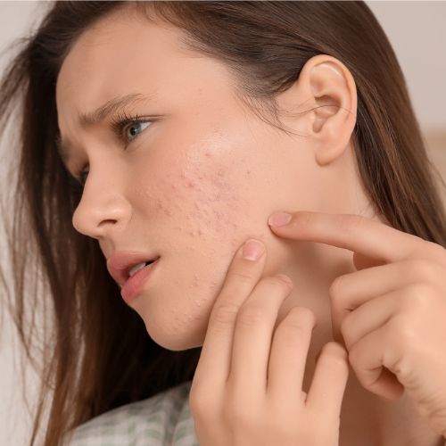 Comment prévenir l'apparition de boutons de transpiration cet été et garder une peau nette