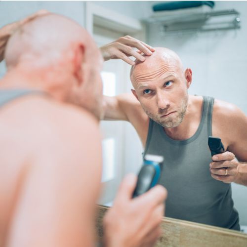 Guía para el cuidado del cuero cabelludo en hombres calvos 