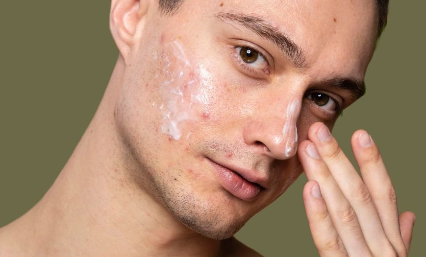 acne hombre nl